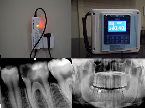 Dental Radiology